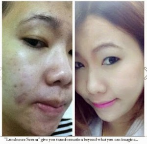 jeunesse-luminesce-before-and-after-pictures